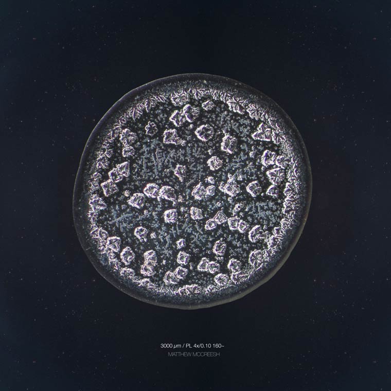 microscope-Tears-images (9)