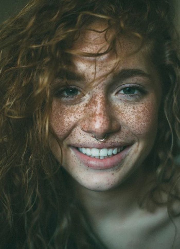 Beautiful Portraits Of Freckled People